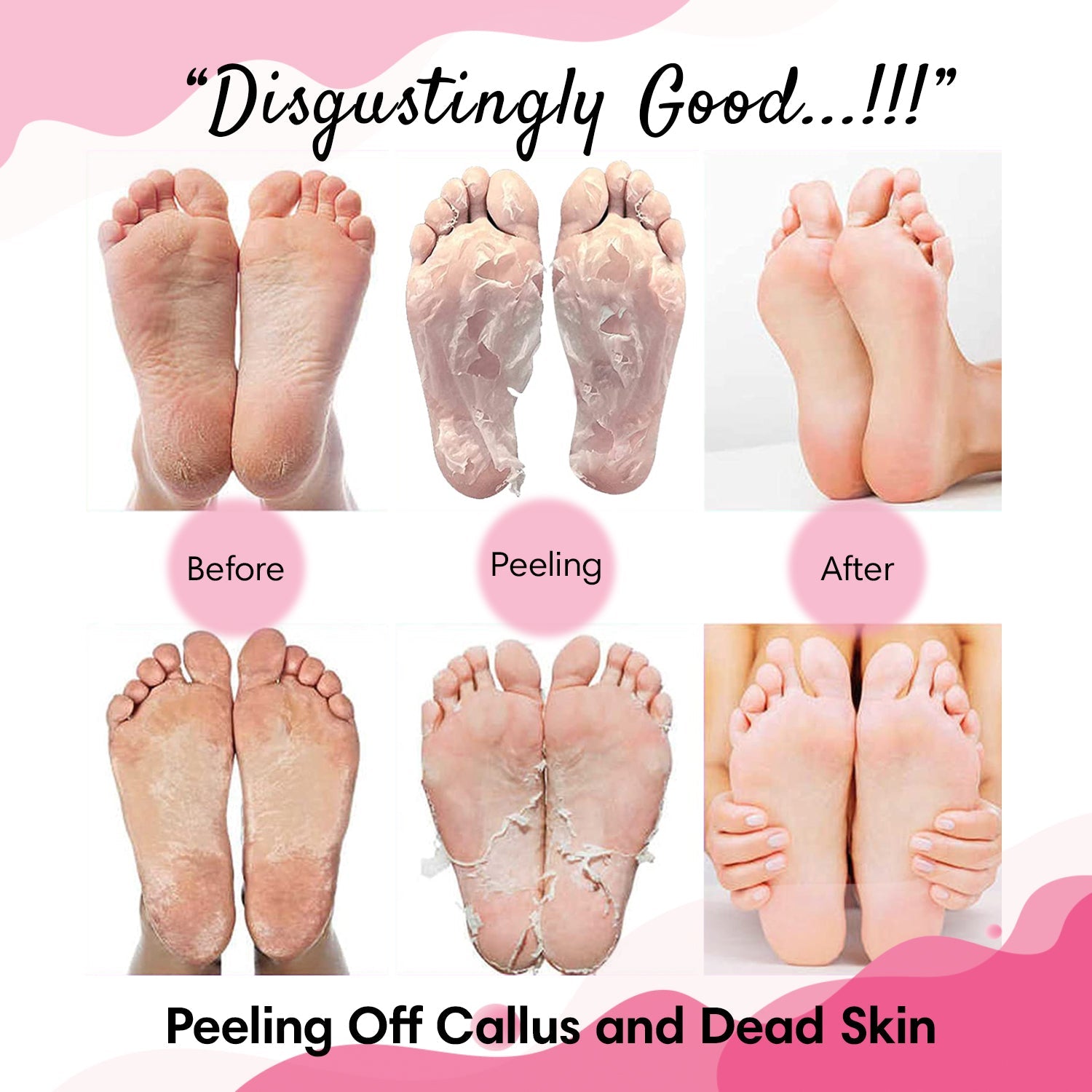 10pcs Exfoliating Peel Off Foot Mask Remove Dead Skin Callus Sock Baby Soft  Feet